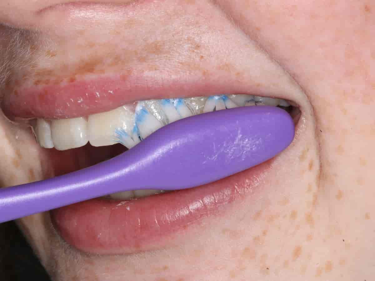 Tannbørste