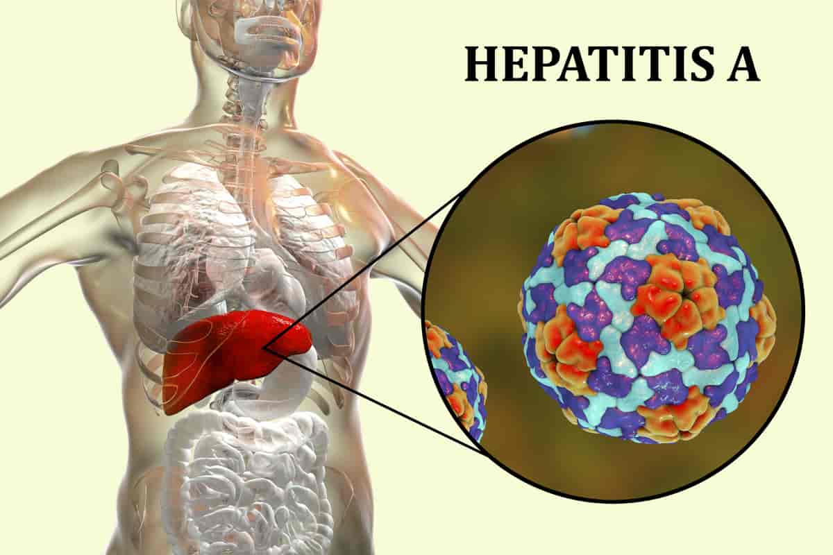 Lever med hepatitt A-virus (HAV)