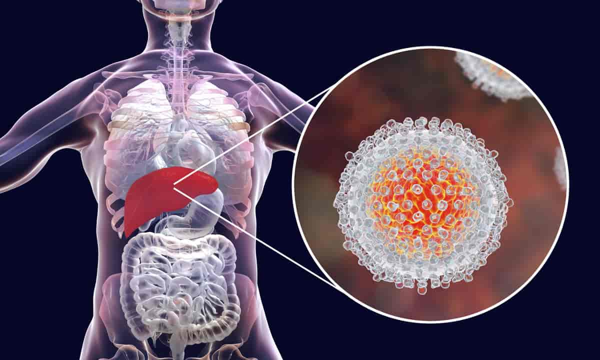 Lever med hepatitt C-virus (HCV)