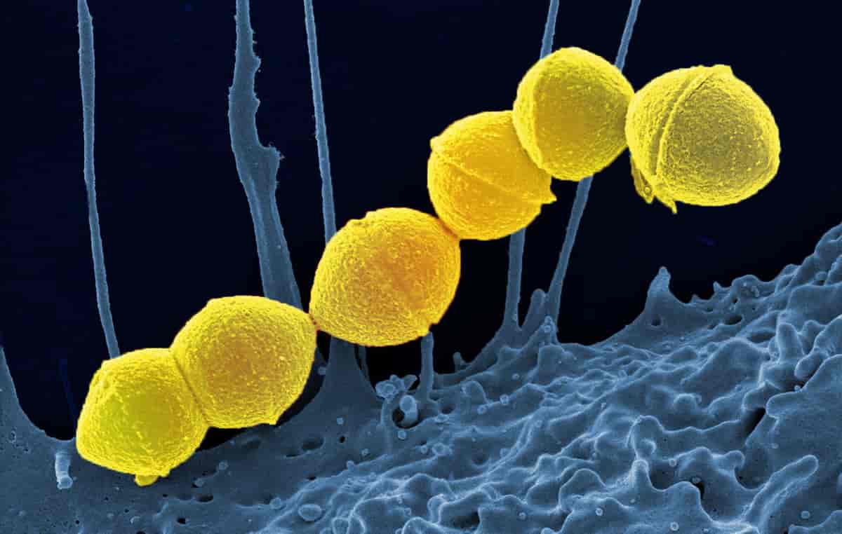 Gruppe A streptokokkbakterier
