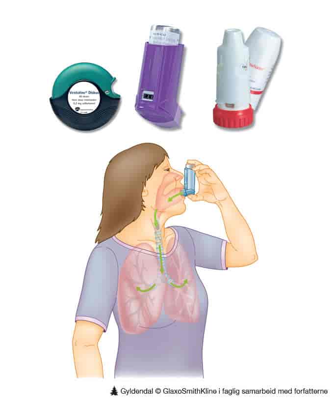 Inhalasjonsaerosol og inhalasjonspulver