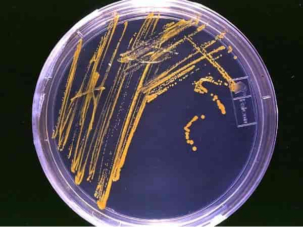 Petriskål med utstryk av bakterier på agar.