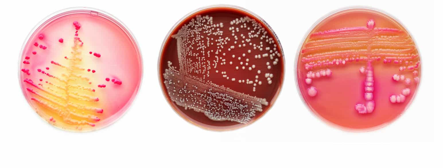 Ulike typer bakterier dyrkes på ulike vekstmedier i petriskål.