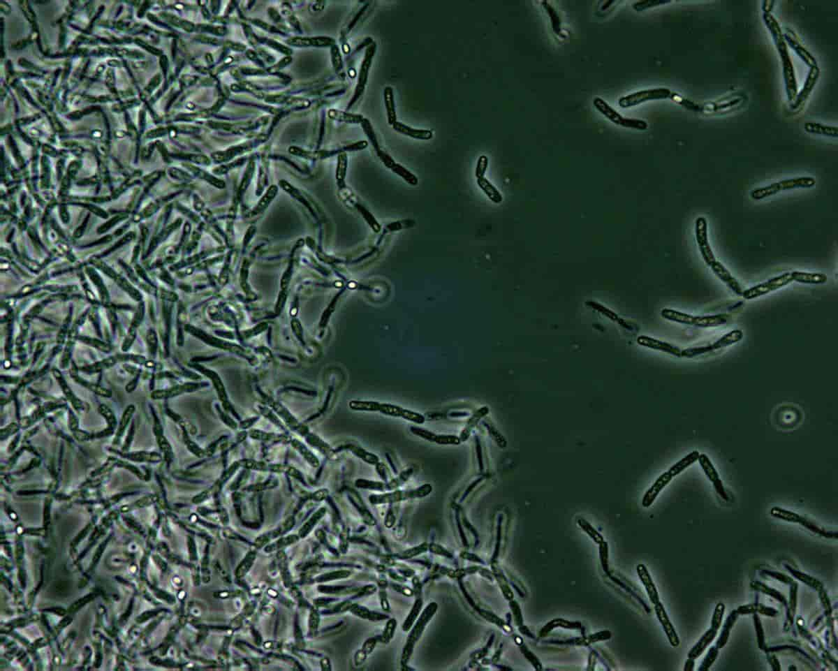 Mikroskopbilde av Bacillus anthracis