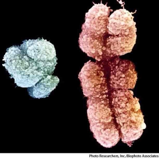 Y-kromosomet (til venstre) og X-kromosomet (til høyre) hos menneske