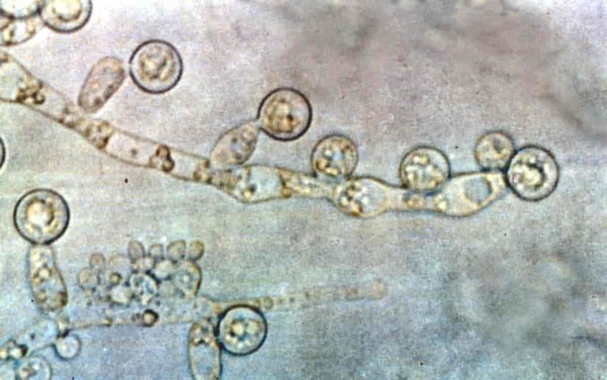 Candida albicans i mikroskop
