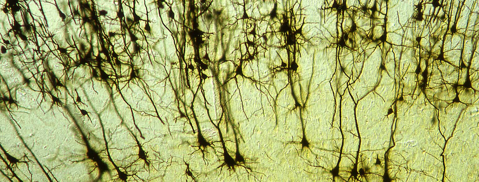 Nerveceller i hjernen