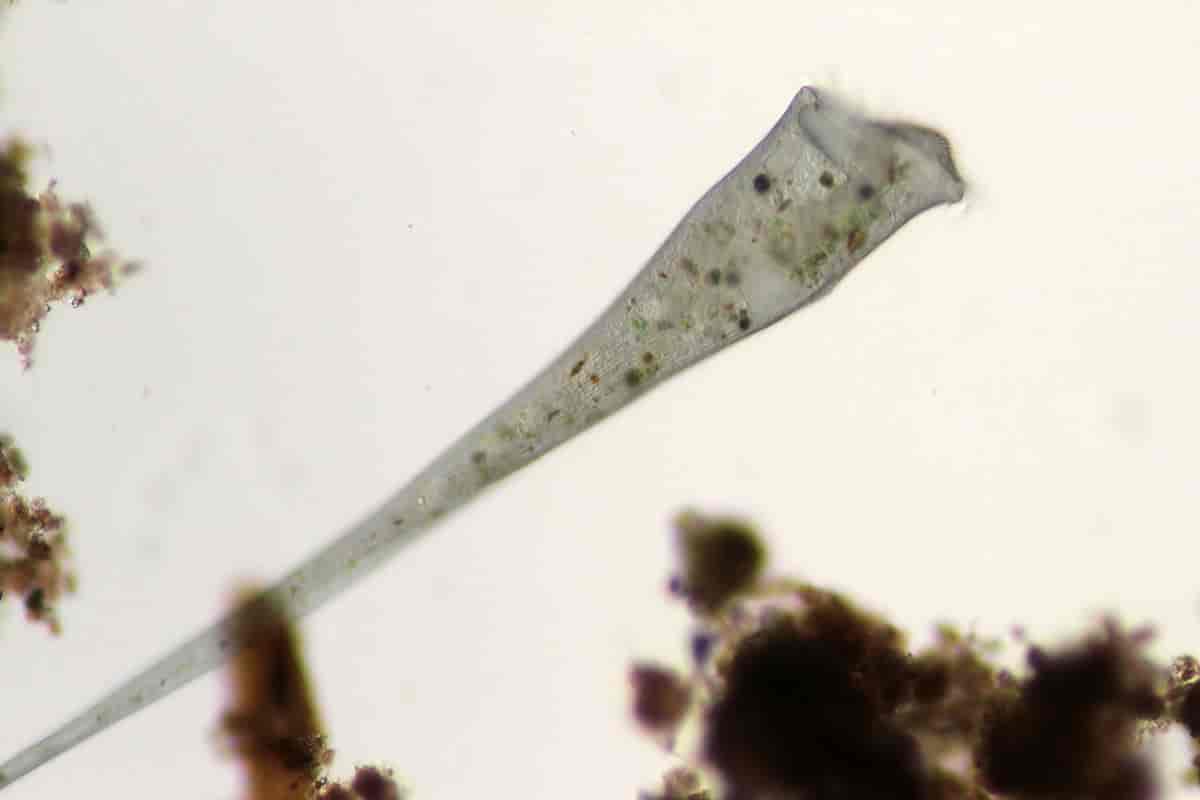 Mikroskopbilde av trompetdyret Stentor coeruleus