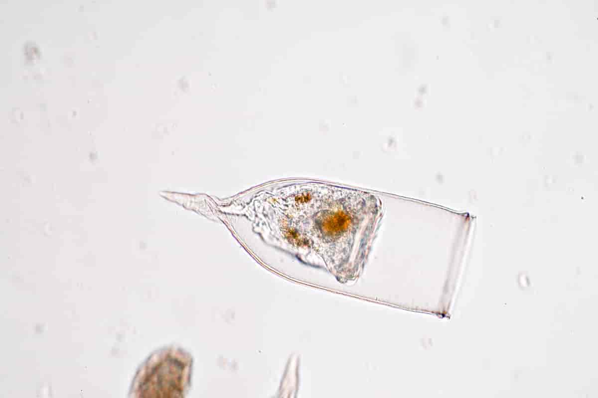 En type Tintinnida i mikroskop
