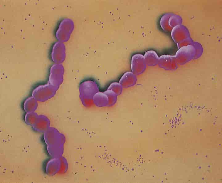 Bakterier (Anatomi og morfologi) (streptokokker)