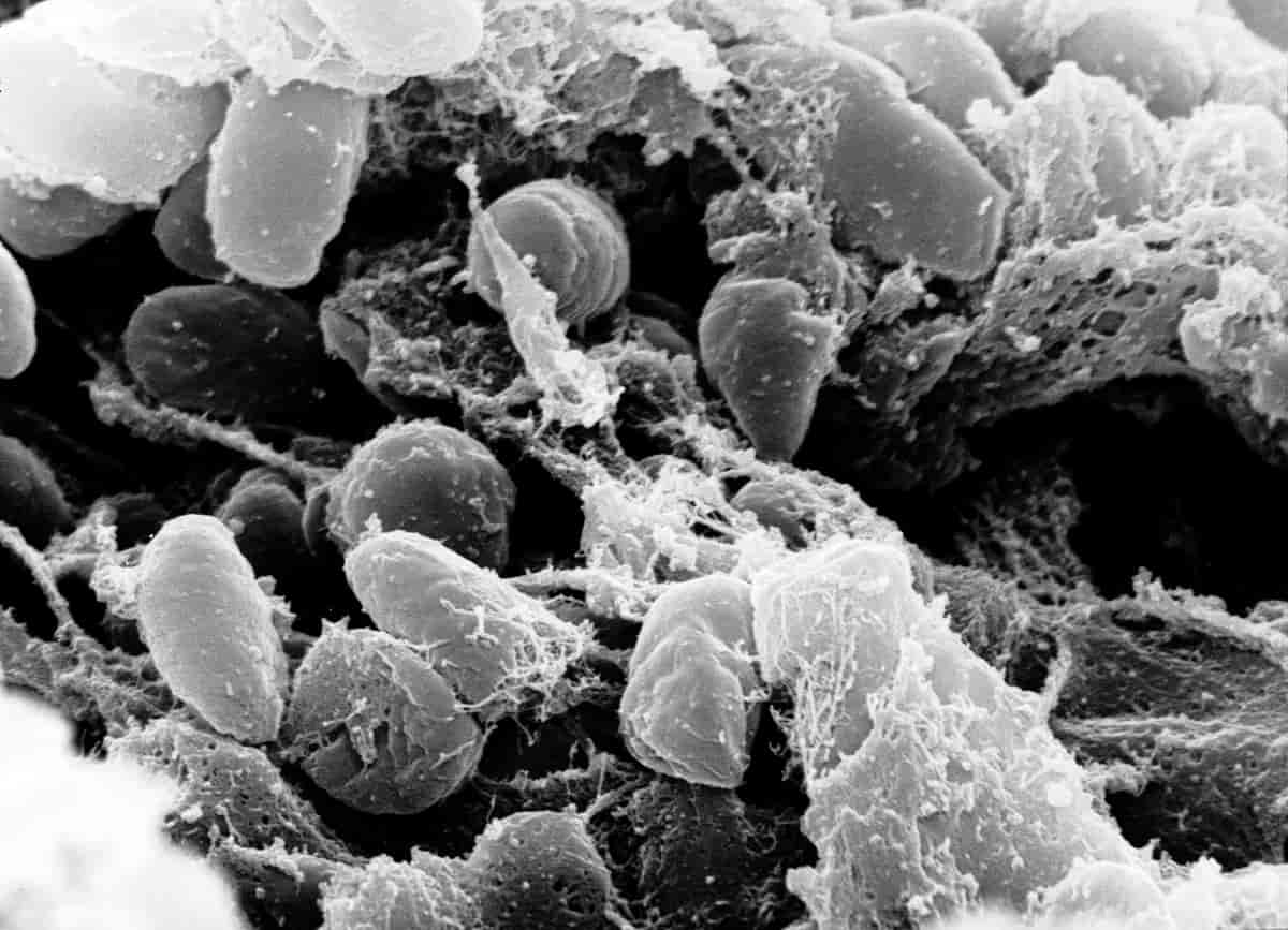 Mikroskopibilde av pestbakterien Yersina pestis