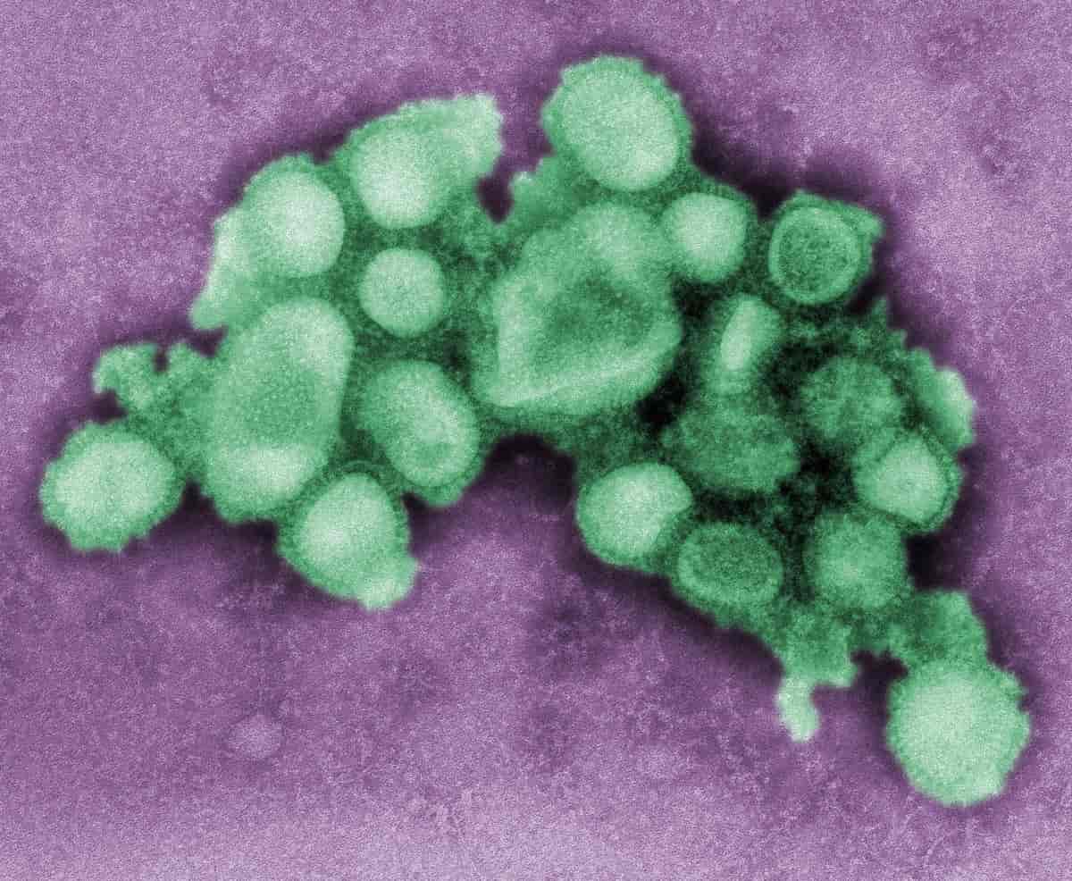 Svineinfluensa-virus