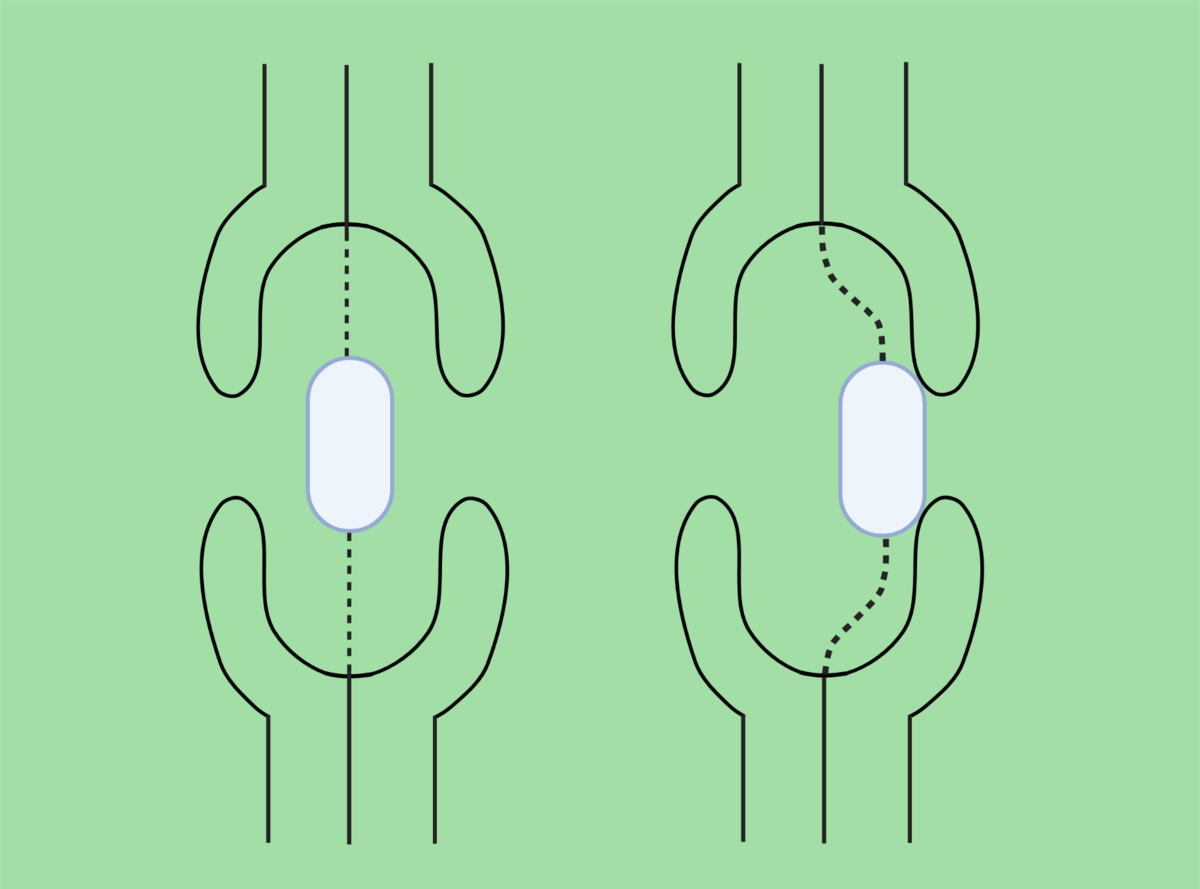 Skjematisk illustrasjon av linsepore