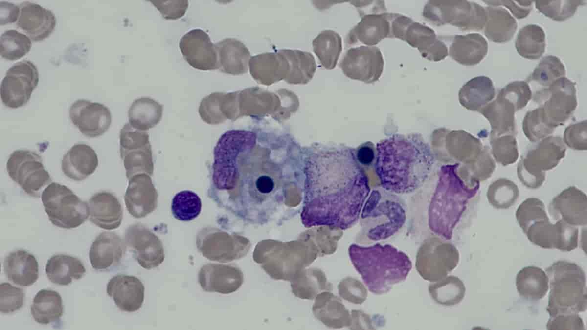 Hemofagocytose