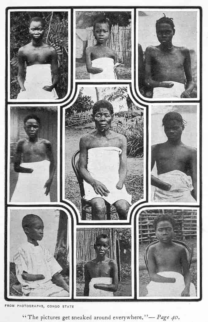 Lemlestede barn og voksne i Kongo.