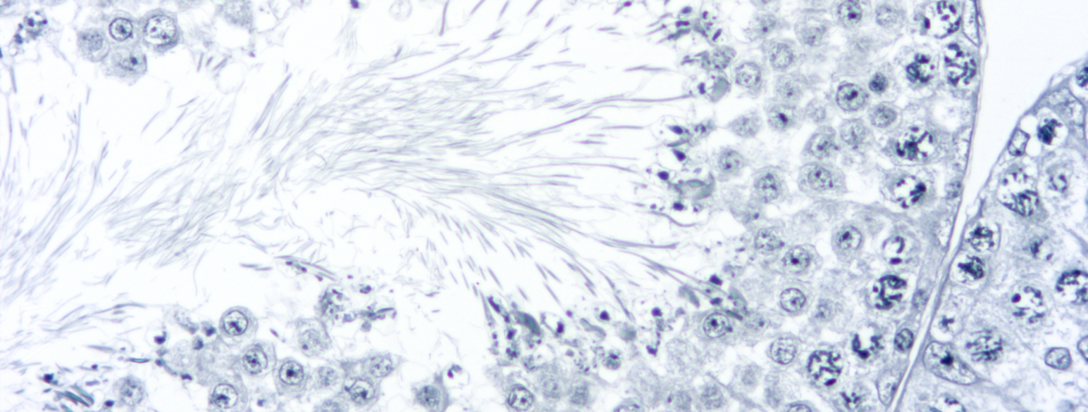 Histologisnitt viser mikroskopi av spermatogenese i menneskelig testikkelvev.