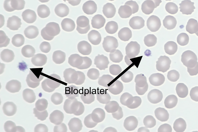 Blodutstryk med blodplater og røde celler