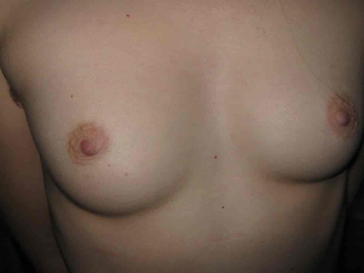 Kvinnelige bryster
