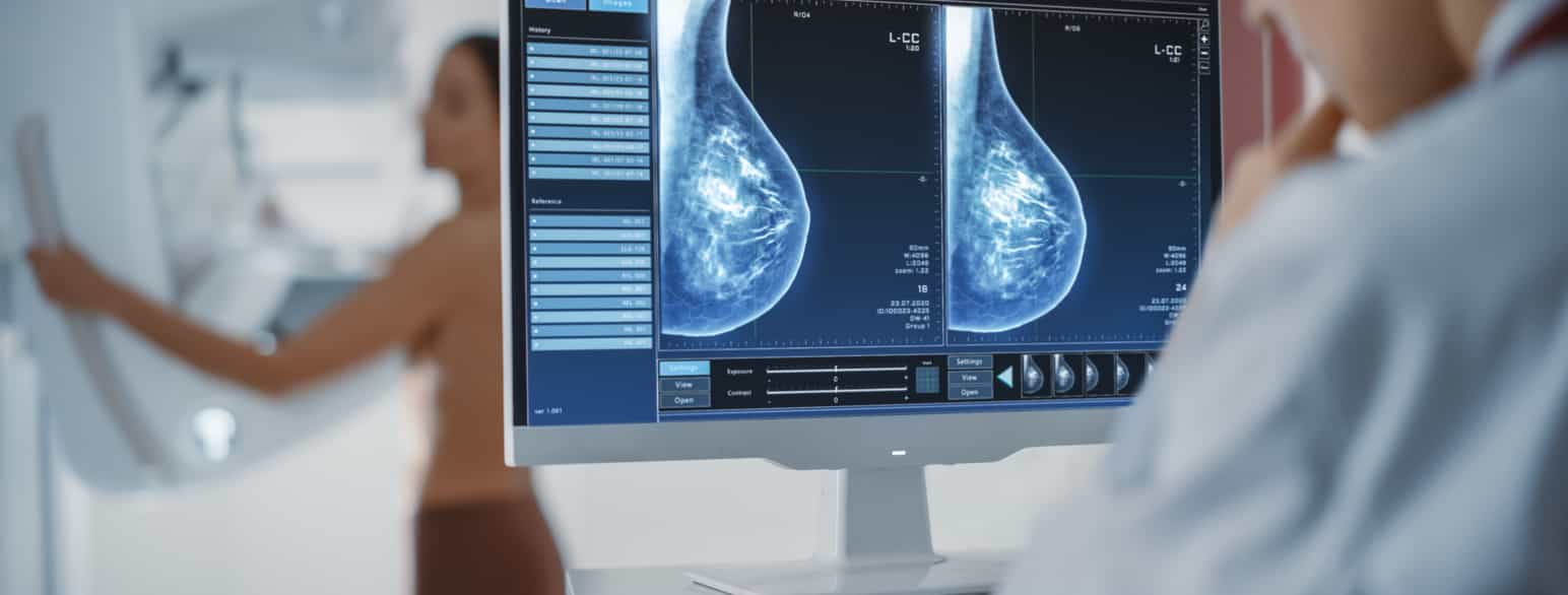 Mammografi benyttes ofte for å avdekke brystkreft