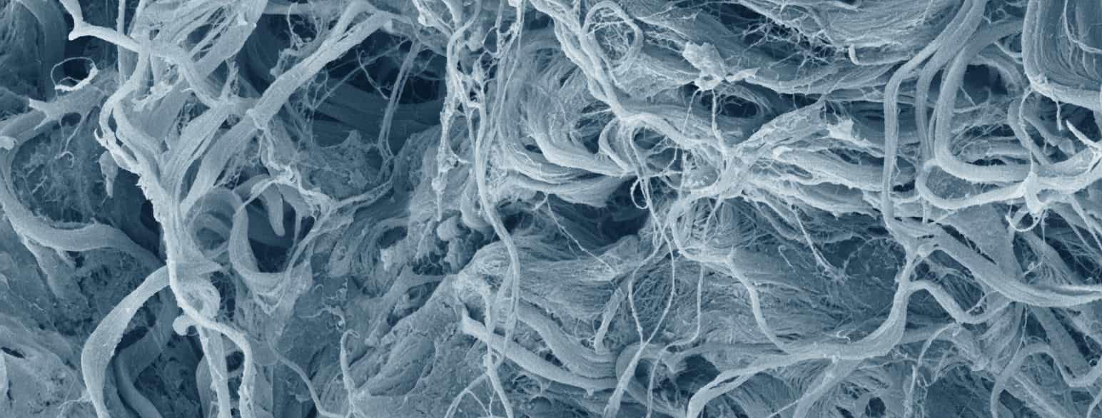 Proteinet kollagen i hud. Bilde fra elektronmikroskop.