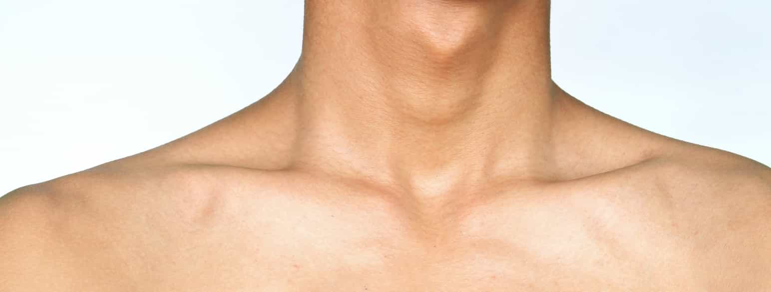 Fotografi av halsen og strupen til ein mann. Adamseplet er den klumpen ein kan se og kjenne på framsida av halsen