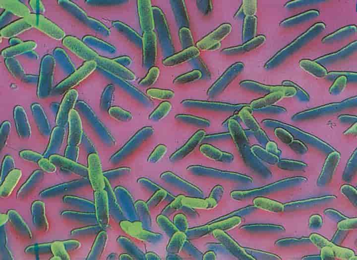 Mikroskopbilde av bakterier som ligner på pølser i formen. 