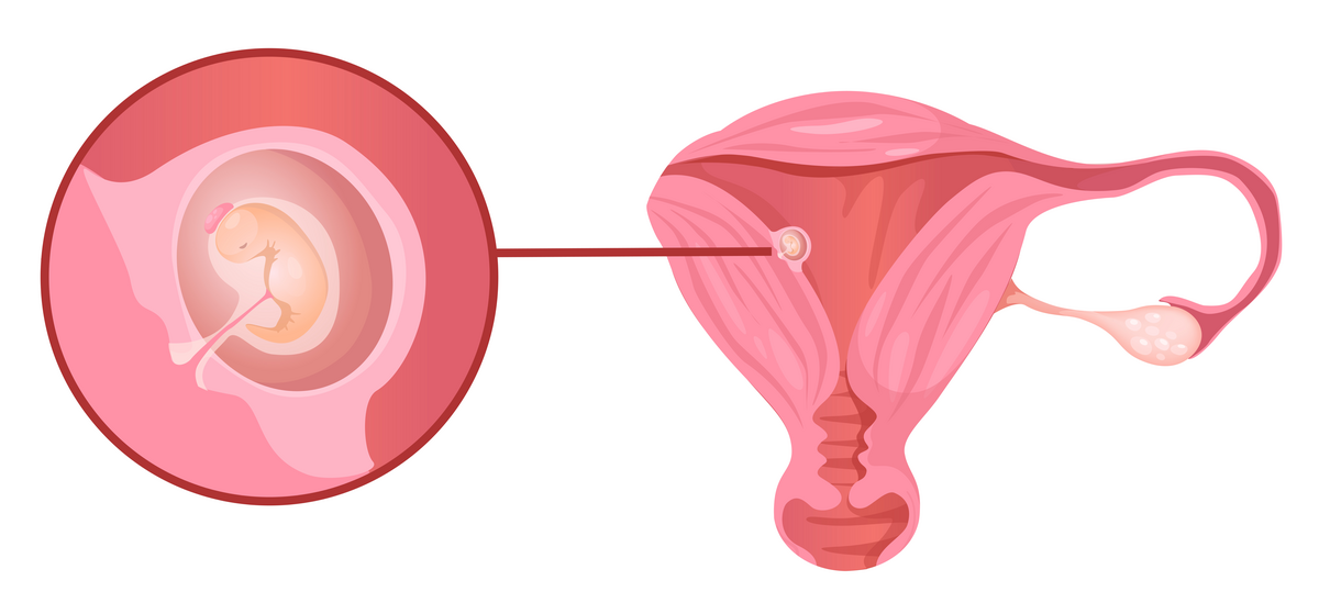 Egg som har festet seg i slimhinnen i livmoren. Inni egget er det et bittelite foster som skal bli til en baby. 