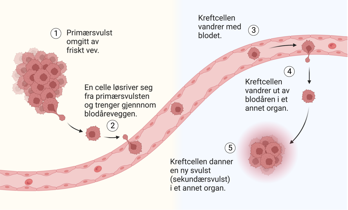 Illustrasjonen viser en klump med celler kalt primærsvulst. En av cellene løsner fra svulsten og trenger inn i en blodåre. Lenger borte går cellen ut av blodåren og danner en ny klump med celler, en sekundærsvulst eller metastase. 