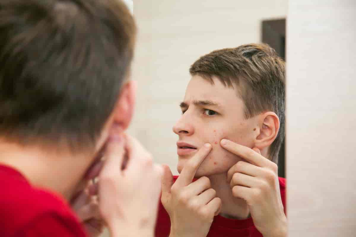 Tenåring ser seg i speilet og klemmer på en kvise.