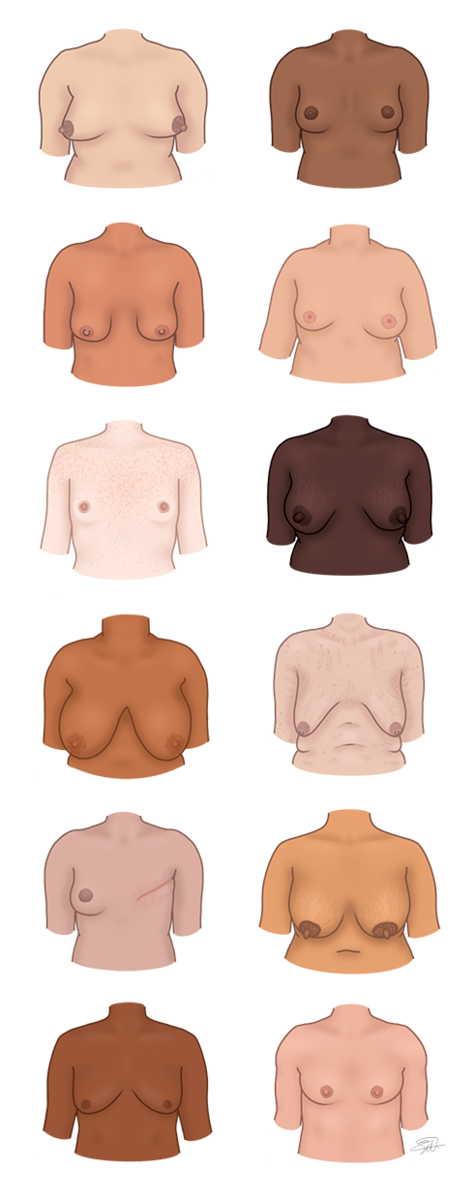 Tolv eksempeltegninger av hvordan pupper kan se ut hos folk av ulik alder, vekt og med forskjellige hudfarger.