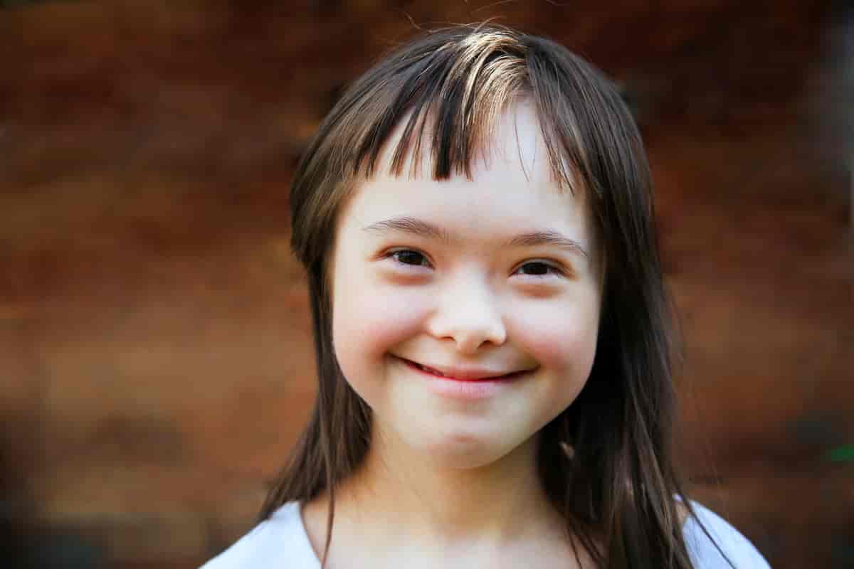 Foto av jente med Downs syndrom