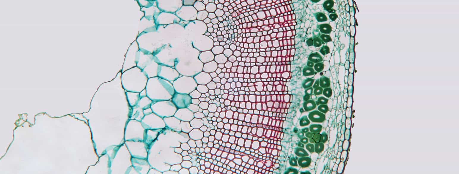 Fotografi fra mikroskop. Tverrsnittet består av mange enkeltrom av ulike størrelser og former. 