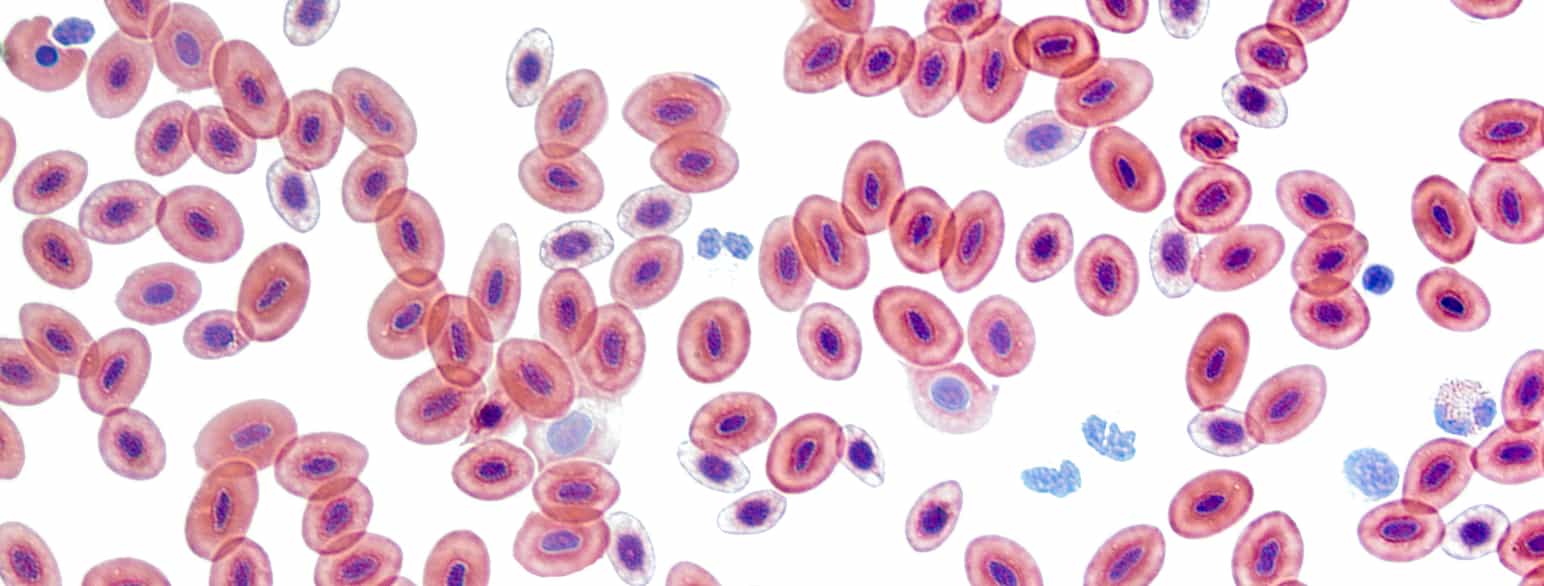 Mikroskopfoto av rundinger med små rundinger i. De store rundingene er blodceller og de indre er cellekjernen. 
