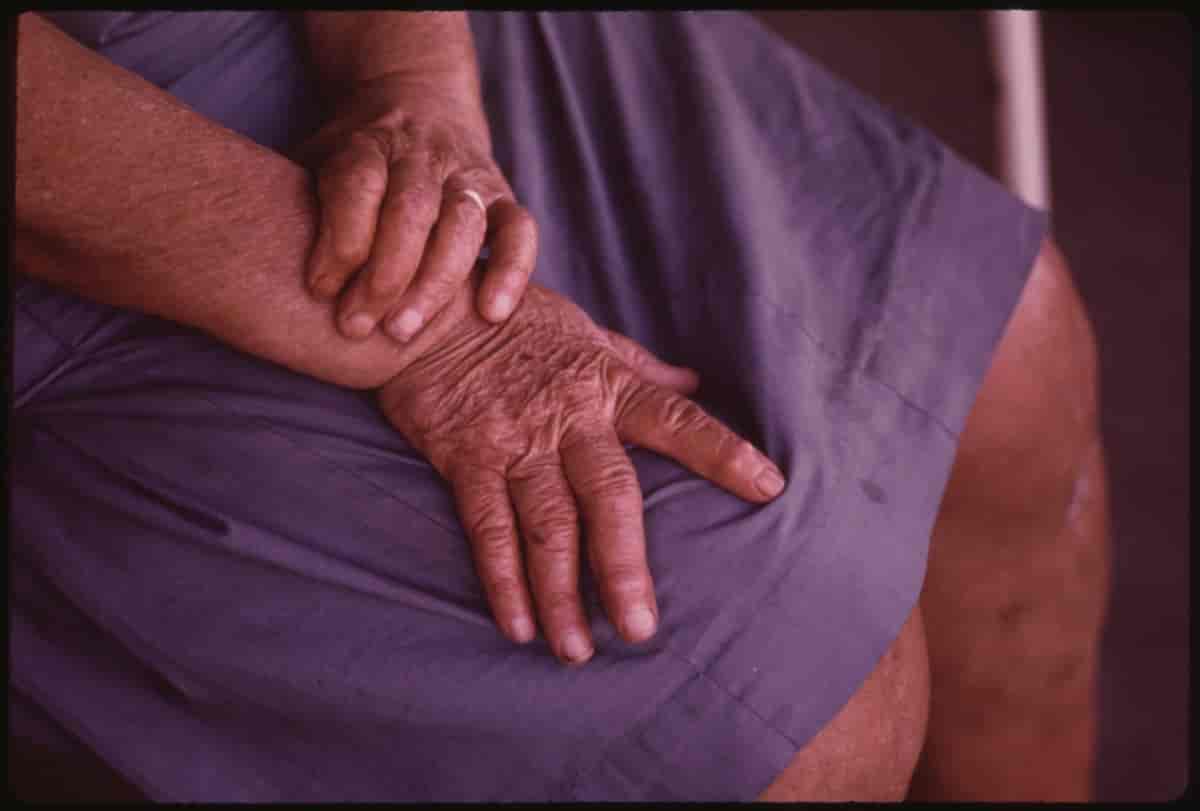 Eldre kvinne med rynkete armer og hender