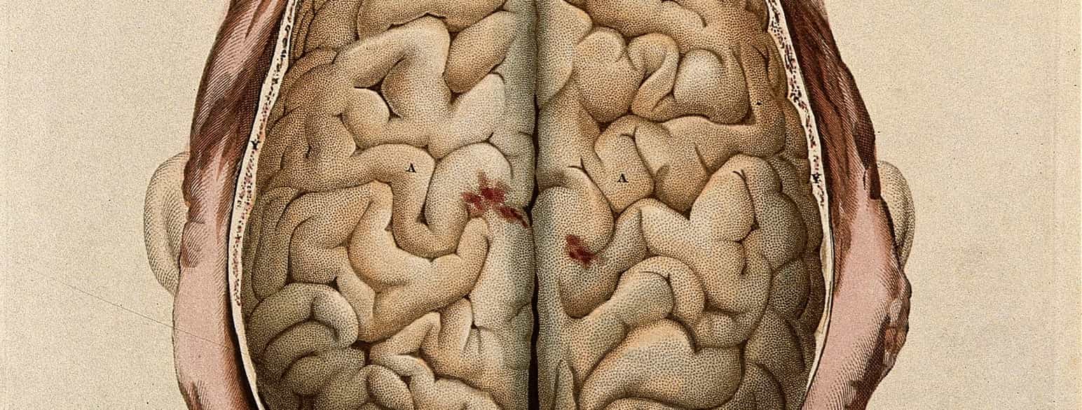 Gravering av hjernen