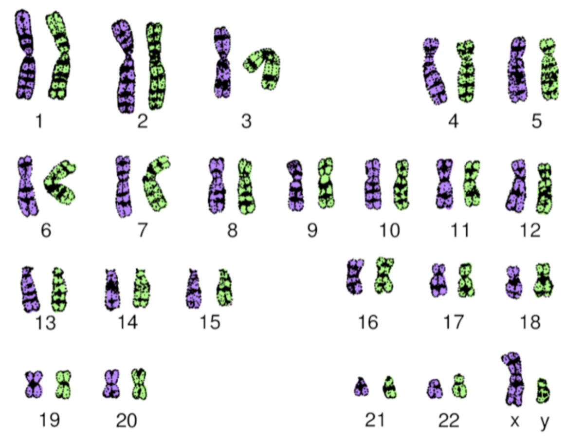 Et svart-hvitt fotografi av 46 kromosomer. De er farget grønn eller lilla avhengig av om kromosomet kommer fra far eller mor. Denne personen har kjønnskromosomene XY.