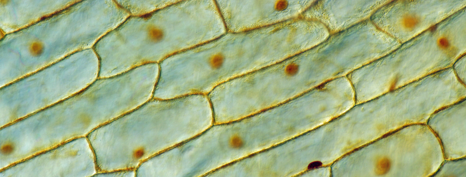 Cellene ser ut som avrundede rektangler og ligger tett inntil hverandre, lag på lag, som mursten i en vegg. Siden de er planteceller har de en ytre hinne og en liten rund kjerne.