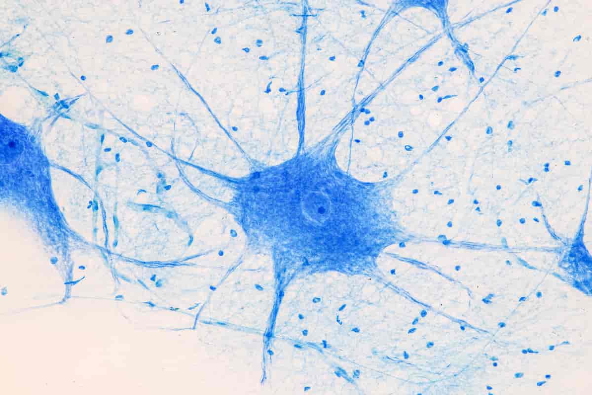 Mikroskopifoto av en nervecelle fra et menneske. Den er farget blå, har en runding i midten som er cellekjernen, og mange utstikkende tråder som den mottar meldinger gjennom.