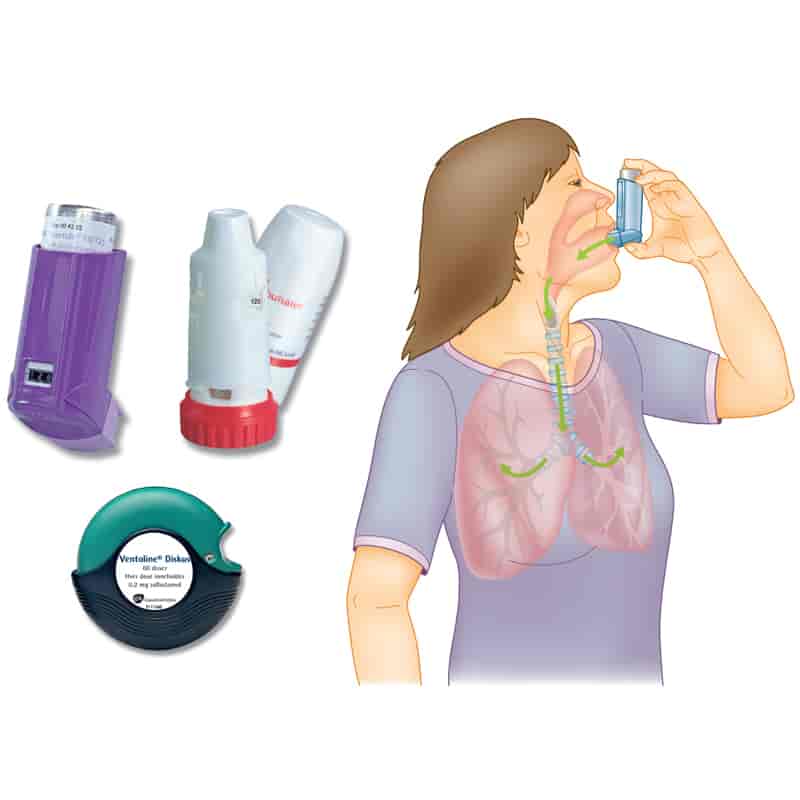 Inhalasjonslegemidler