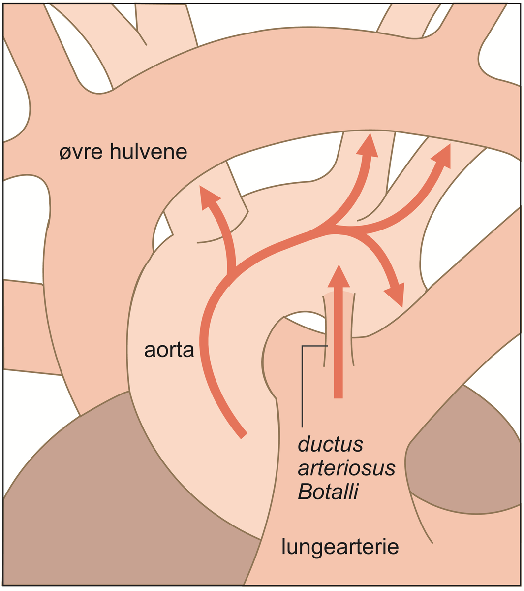 Ductus arteriosus Botalli