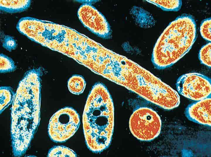 Bakterier (Anatomi og morfologi) (Legionella)