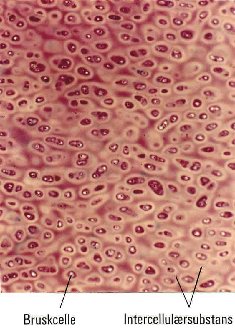 Brusk (hyalin brusk, mikroskopisk bilde)