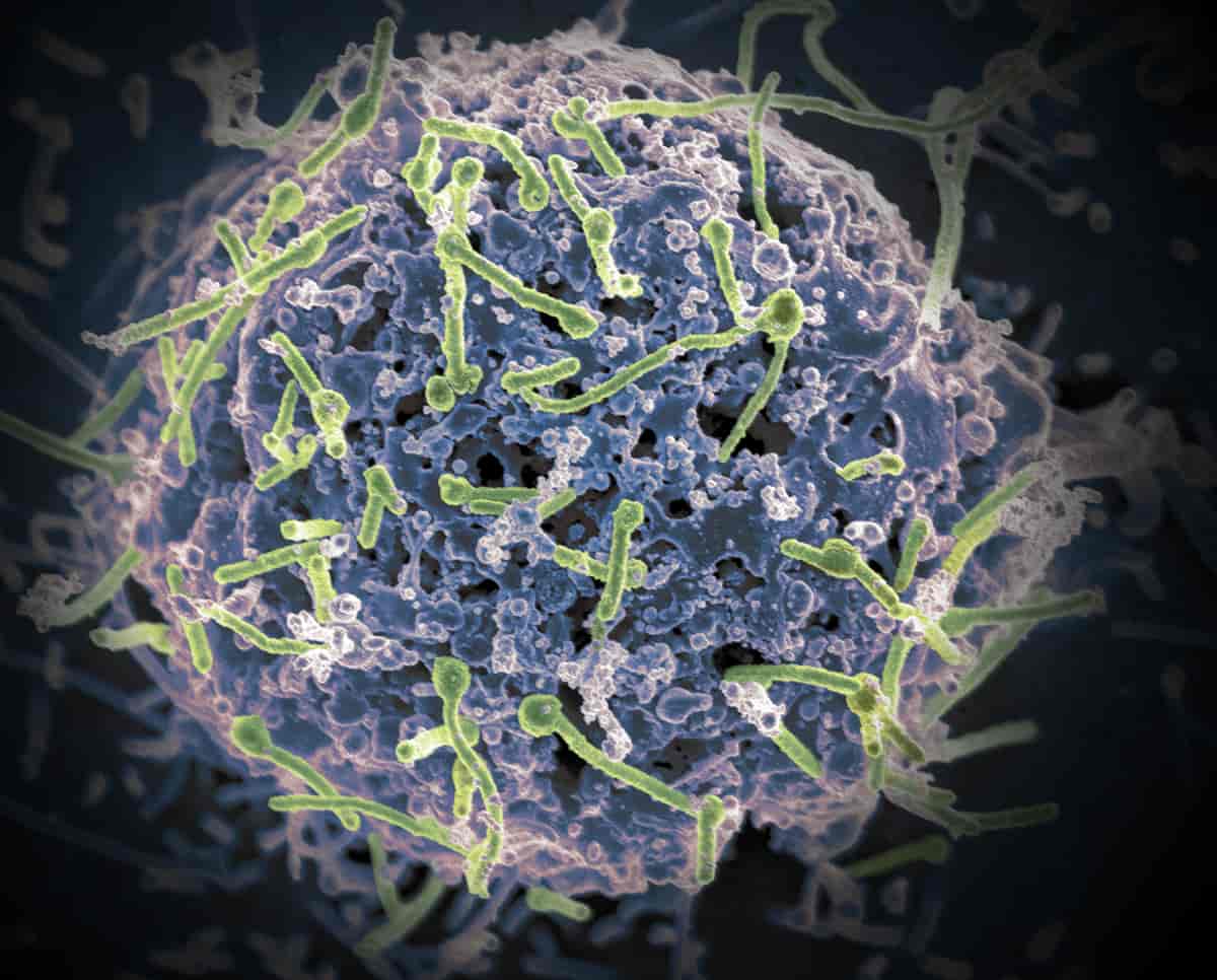 Ebolavirus på overflaten til en celle