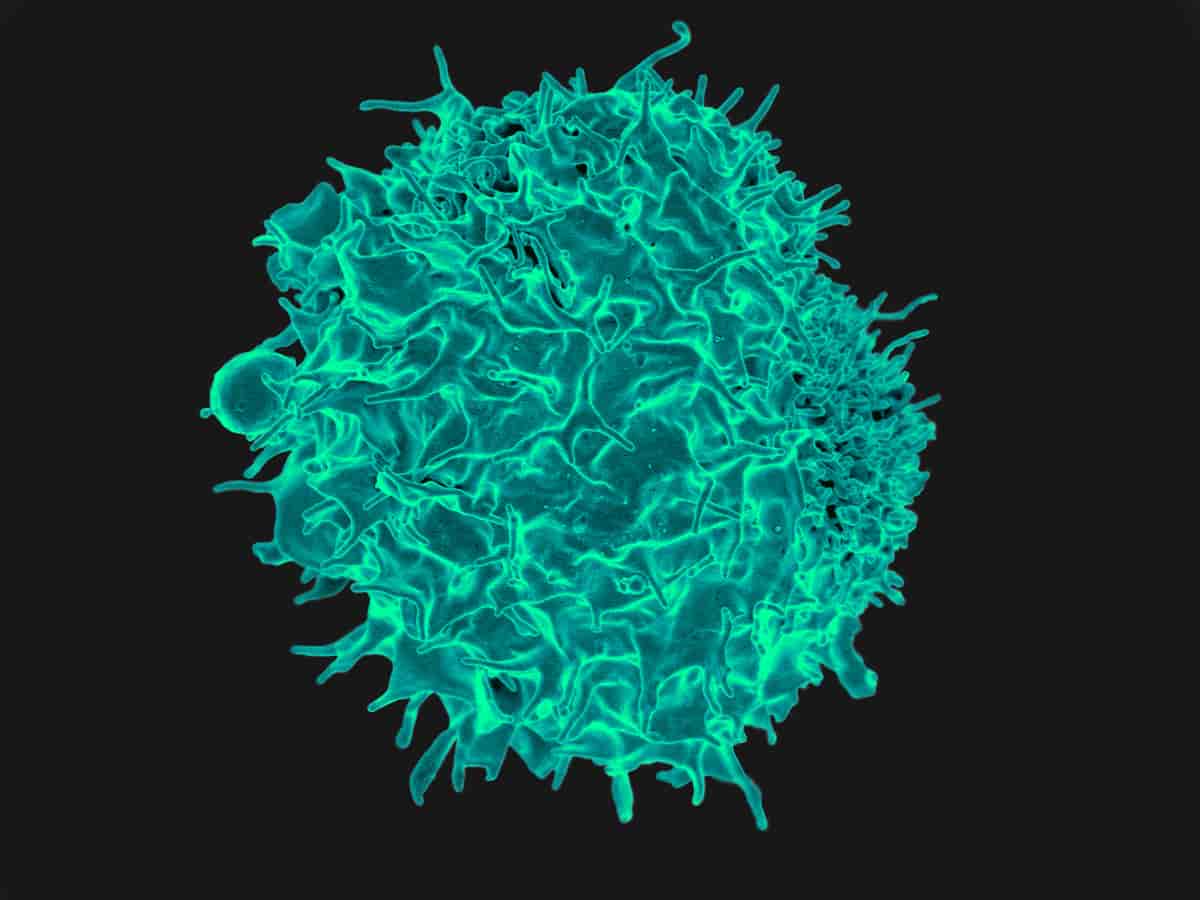 T-lymfocytt