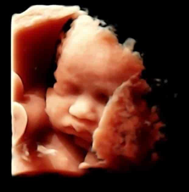 3D ultralydbilde under svangerskapet av hodet til et normalt foster