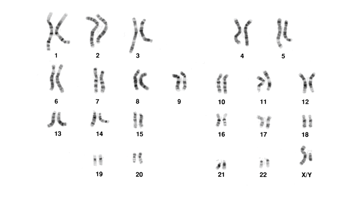 Menneskets karyotype