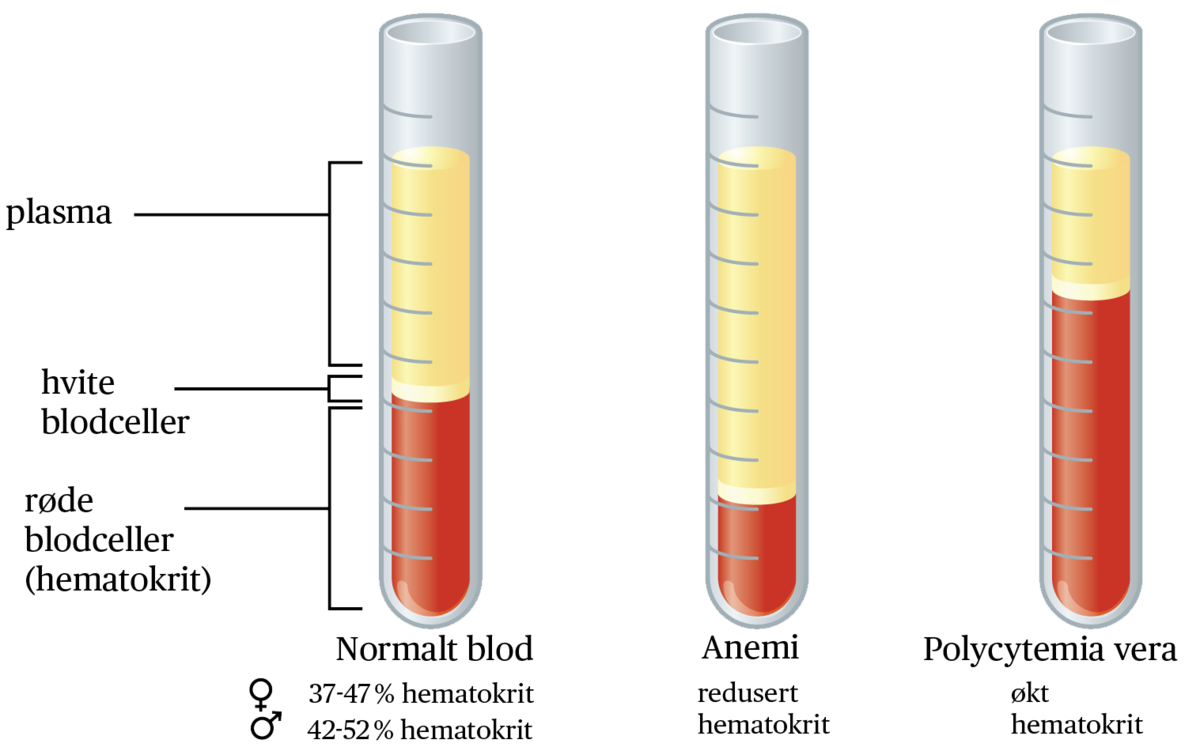 تحليل haematocrit تحليل hct منخفض معنى hct في تحليل الدم